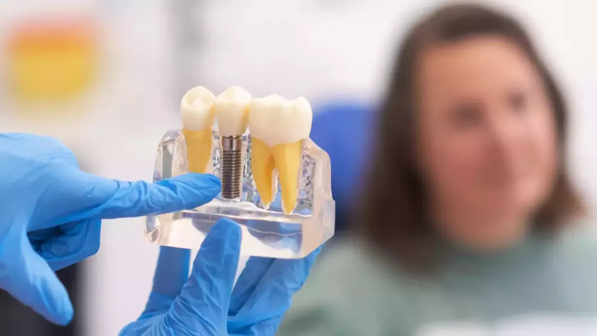 Dental Implant Treatment